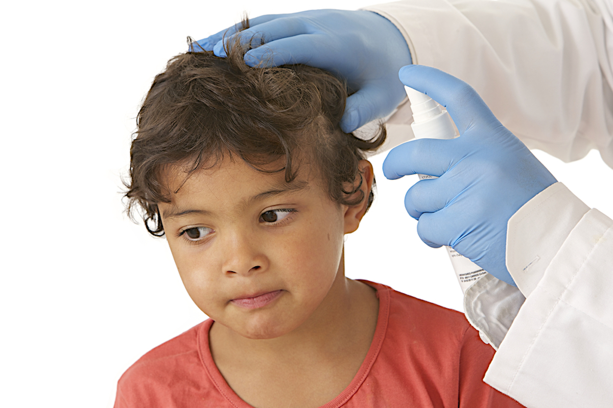 Lice Treatment For Children