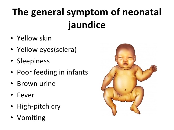 Jaundice in Newborns Things Parenting