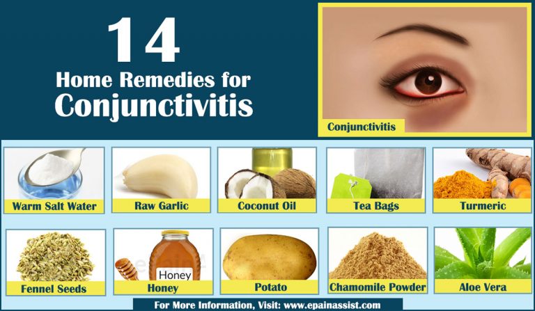 6-things-to-know-about-conjunctivitis-in-children-pink-eye-page-4